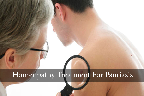Homeopathy Treatment for Psoriasis