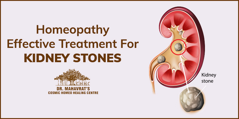 Homeopathy Treatment For Kidney Stones-Chhc