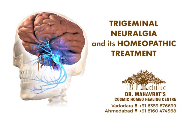 Trigeminal Neuralgia