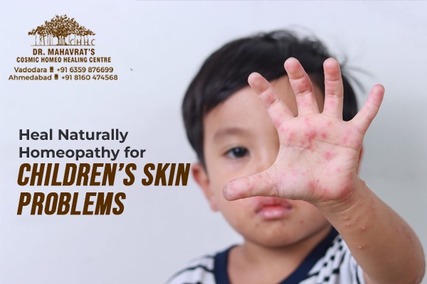 homoeopathic treatment for skin allergies