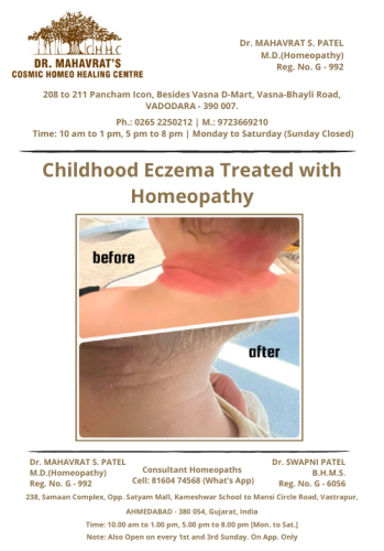 childhood eczema